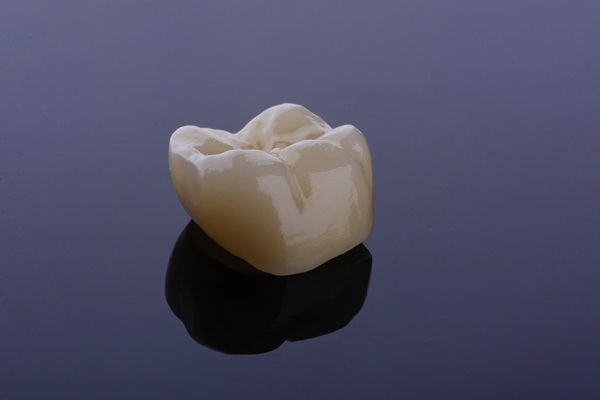 What To Expect With CEREC Crowns: Steps, Benefits, And Aftercare