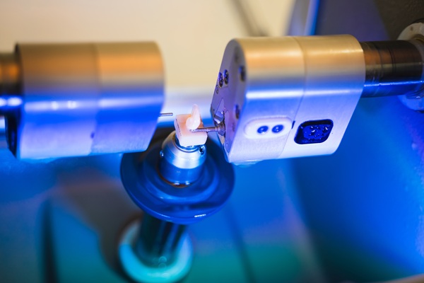 What To Ask At A CEREC Crown Consultation