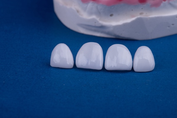 The FAQs Of Zirconia Crowns