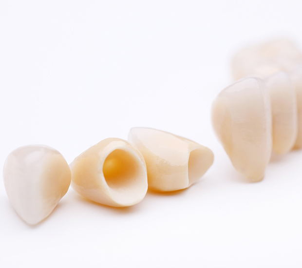 Brookfield Dental Crowns and Dental Bridges