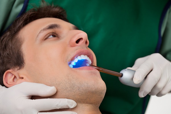 Three Questions To Ask Your Dentist About White Dental Fillings