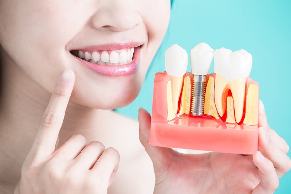 How Is A Dental Implant Placed?