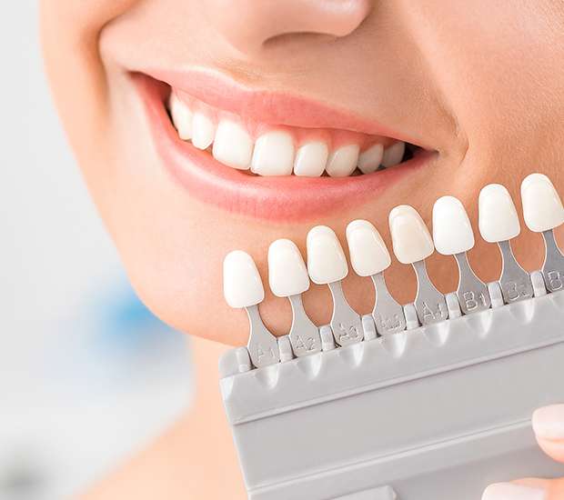 Brookfield Dental Veneers