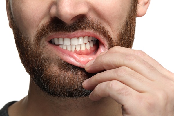 Gum Disease Treatment For Each Stage Of The Disease