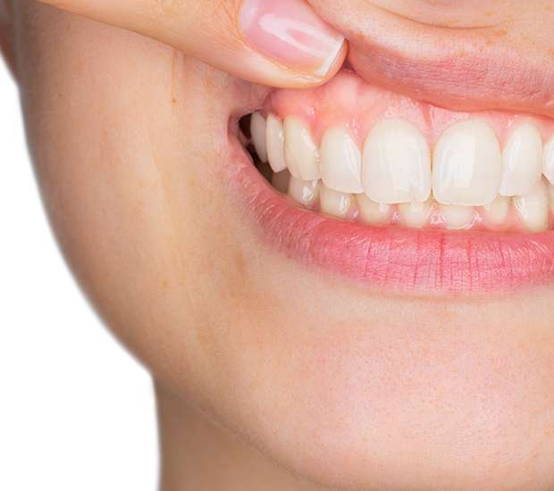 Brookfield Gum Disease