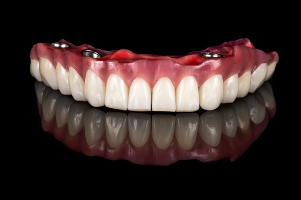 Benefits Of Implant Supported Dentures
