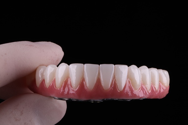 Benefits Of Implant Supported Dentures