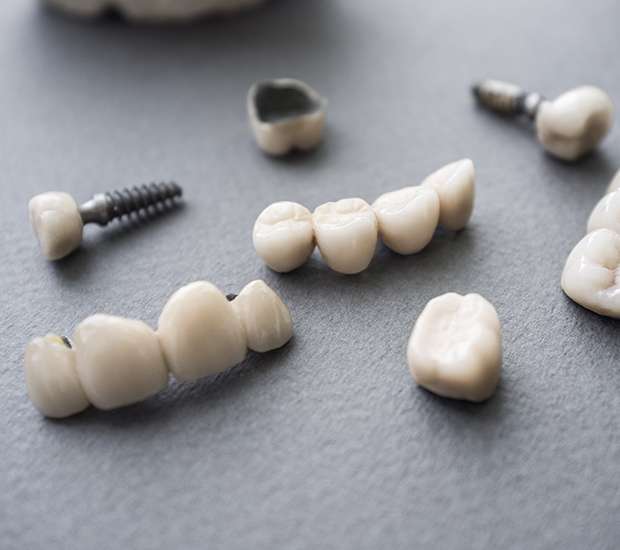 Brookfield The Difference Between Dental Implants and Mini Dental Implants