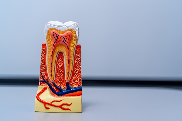 Possible Complications Of Root Canals And How To Avoid Them